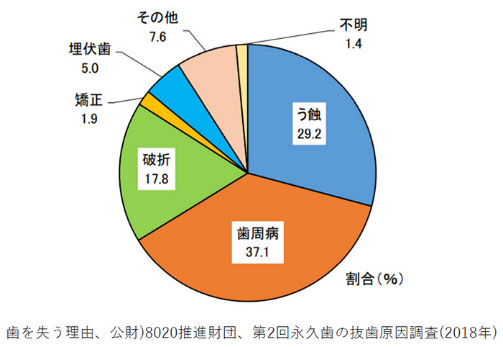 抜歯の3大要素