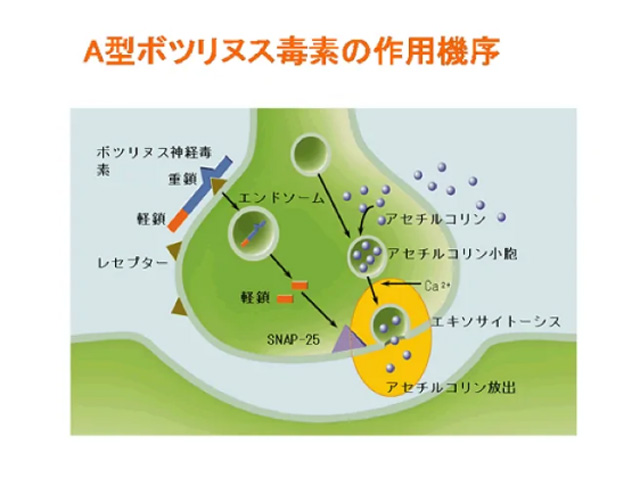ボトックスの詳しい情報